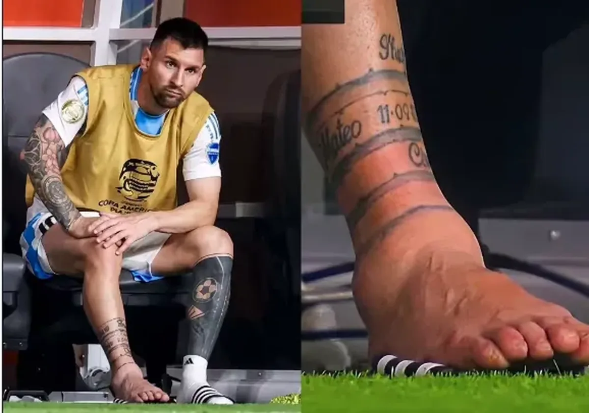 Entorse no tornozelo direito de Messi provoca edema; entenda a lesão