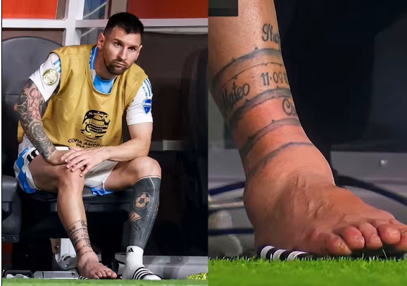 Imagem da notícia: Susto no Craque: Entorse Grave Provoca Edema Exuberante no Tornozelo Direito de Messi — Entenda a Lesão